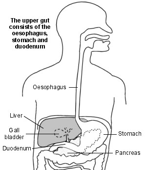 Stomach Cancer